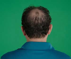 Hair Grow Max 2x1 a 1.261 CZK